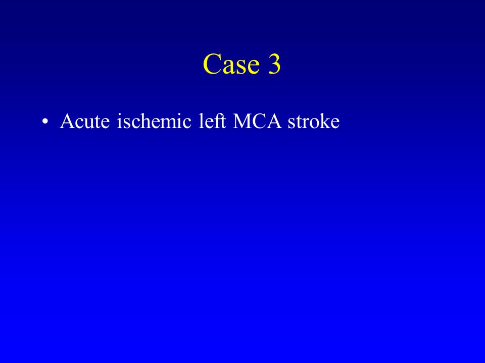 case study mca stroke